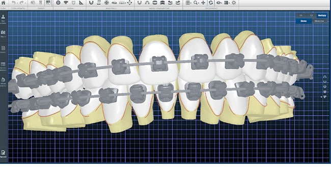 aparat ortodontyczny poznań